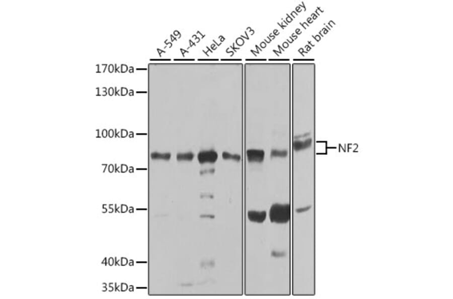 Western Blot - Anti-NF2/Merlin Antibody (A93014) - Antibodies.com