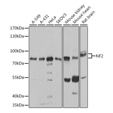 Western Blot - Anti-NF2/Merlin Antibody (A93014) - Antibodies.com