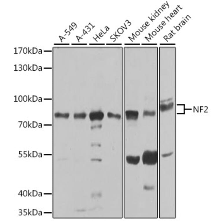 Western Blot - Anti-NF2/Merlin Antibody (A93014) - Antibodies.com