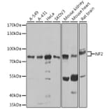 Western Blot - Anti-NF2/Merlin Antibody (A93014) - Antibodies.com