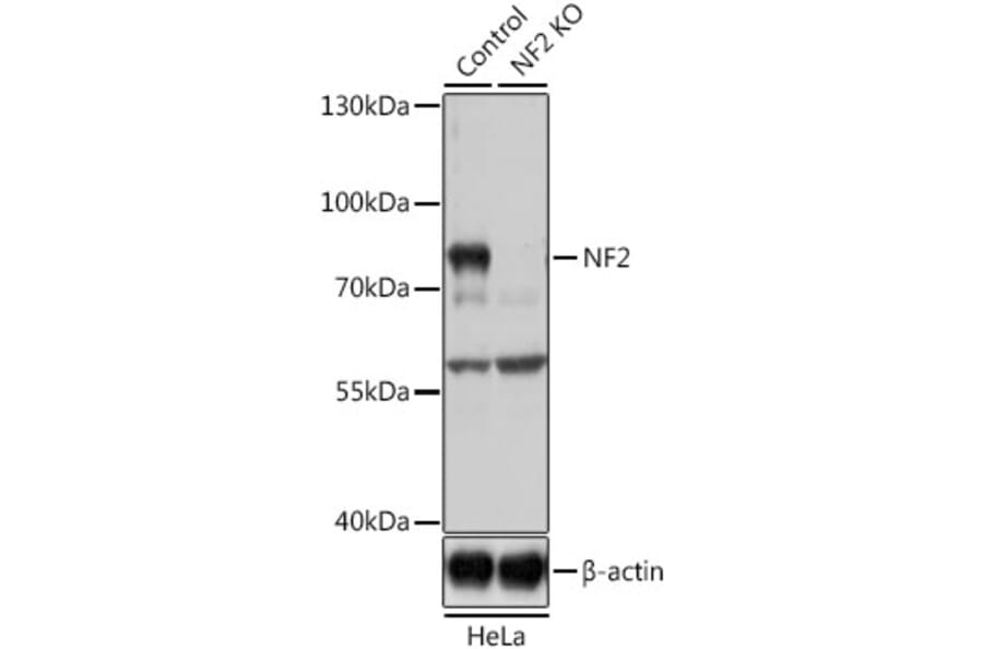 Western Blot - Anti-NF2/Merlin Antibody (A93014) - Antibodies.com