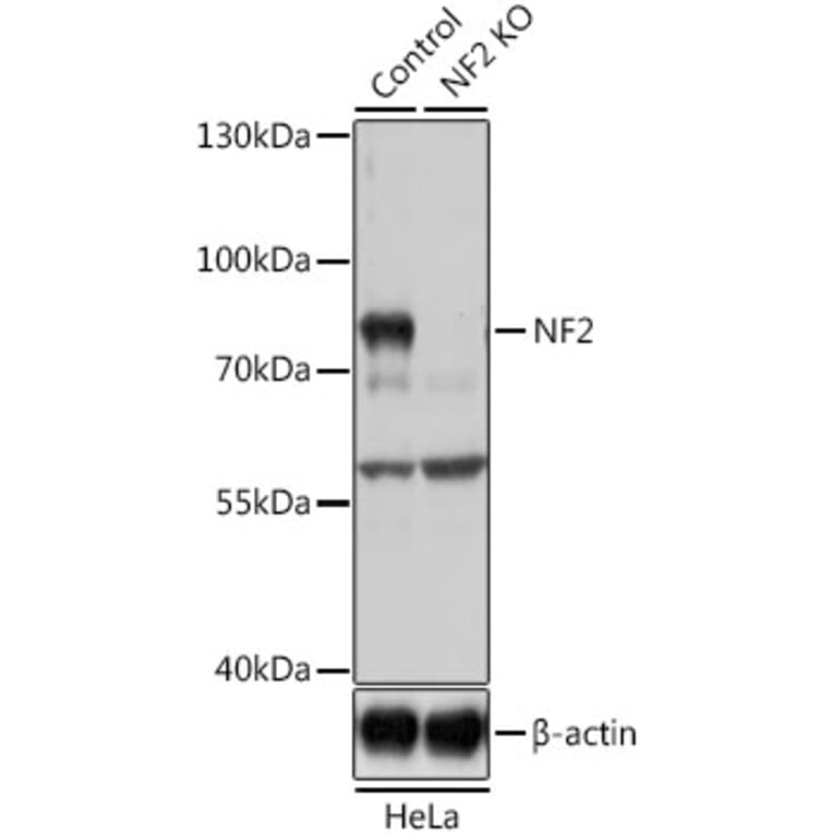 Western Blot - Anti-NF2/Merlin Antibody (A93014) - Antibodies.com