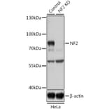 Western Blot - Anti-NF2/Merlin Antibody (A93014) - Antibodies.com