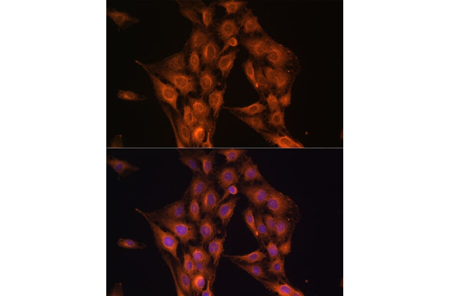 Immunofluorescence - Anti-NF2/Merlin Antibody (A93014) - Antibodies.com