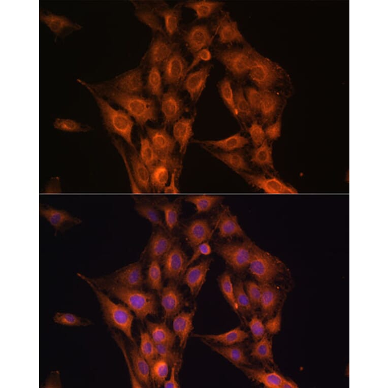 Immunofluorescence - Anti-NF2/Merlin Antibody (A93014) - Antibodies.com