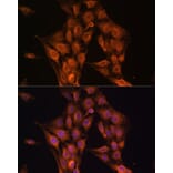 Immunofluorescence - Anti-NF2/Merlin Antibody (A93014) - Antibodies.com