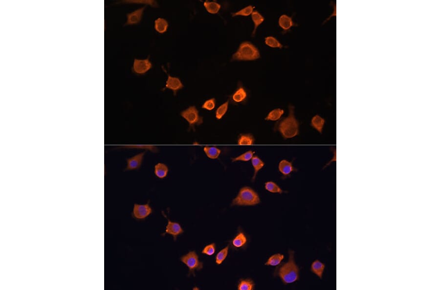 Immunofluorescence - Anti-NF2/Merlin Antibody (A93014) - Antibodies.com