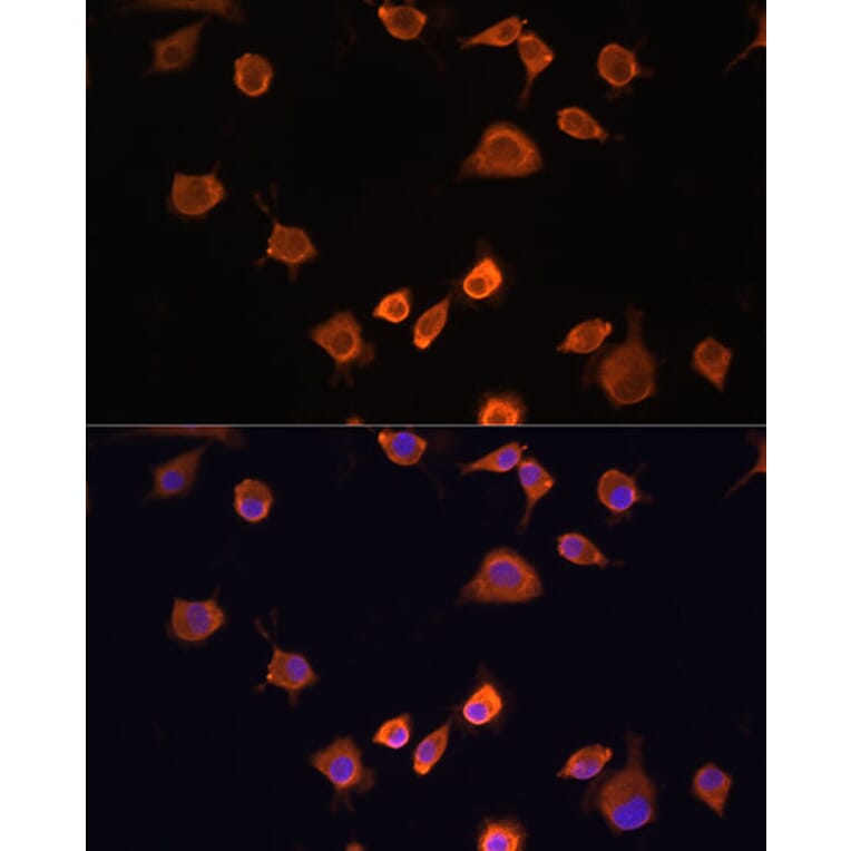 Immunofluorescence - Anti-NF2/Merlin Antibody (A93014) - Antibodies.com
