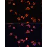 Immunofluorescence - Anti-NF2/Merlin Antibody (A93014) - Antibodies.com
