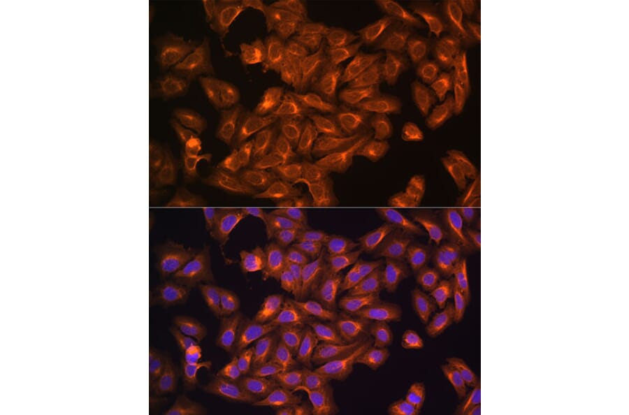 Immunofluorescence - Anti-NF2/Merlin Antibody (A93014) - Antibodies.com