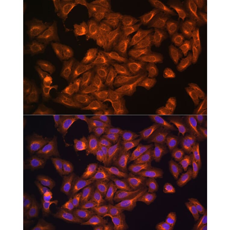 Immunofluorescence - Anti-NF2/Merlin Antibody (A93014) - Antibodies.com