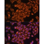 Immunofluorescence - Anti-NF2/Merlin Antibody (A93014) - Antibodies.com