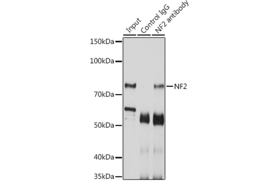 Western Blot - Anti-NF2/Merlin Antibody (A93014) - Antibodies.com
