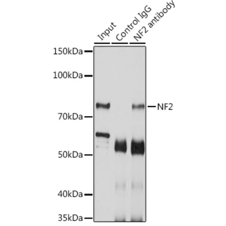 Western Blot - Anti-NF2/Merlin Antibody (A93014) - Antibodies.com