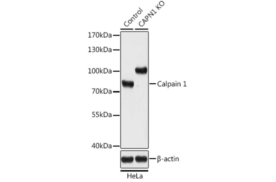 Western Blot - Anti-Calpain 1 Antibody (A93017) - Antibodies.com