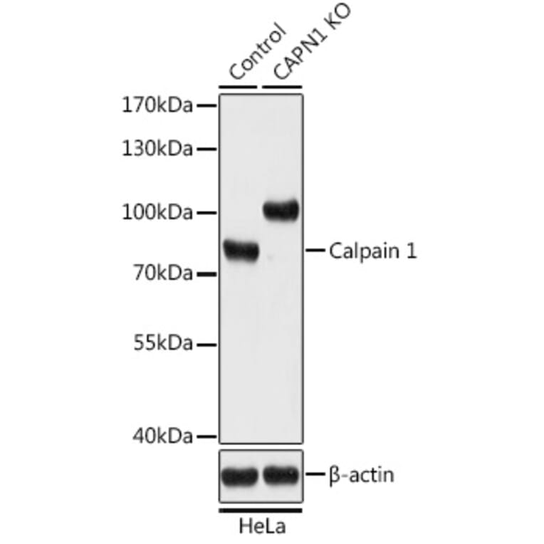 Western Blot - Anti-Calpain 1 Antibody (A93017) - Antibodies.com