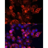 Immunofluorescence - Anti-CD44 Antibody (A93018) - Antibodies.com