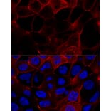 Immunofluorescence - Anti-CD44 Antibody (A93018) - Antibodies.com