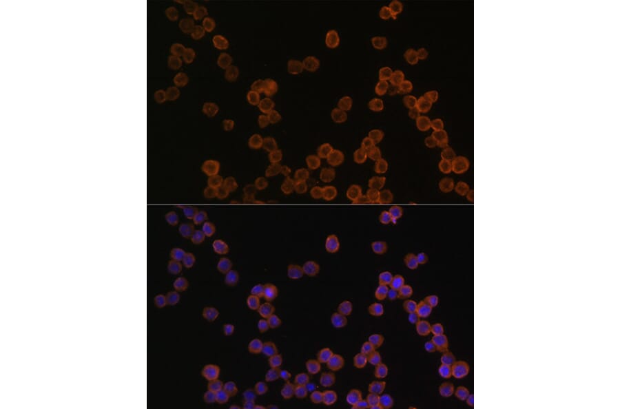 Immunofluorescence - Anti-CD44 Antibody (A93018) - Antibodies.com