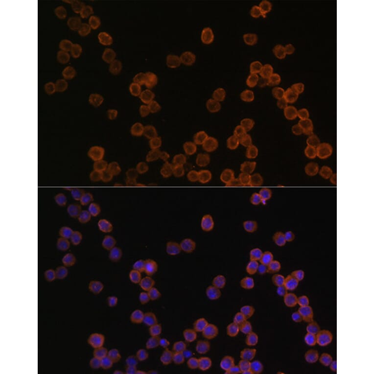 Immunofluorescence - Anti-CD44 Antibody (A93018) - Antibodies.com