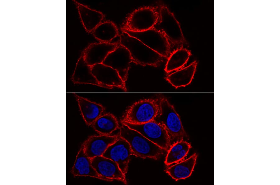 Immunofluorescence - Anti-CD44 Antibody (A93018) - Antibodies.com