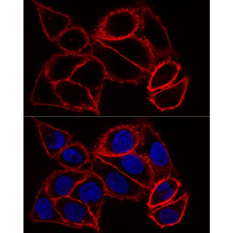 Immunofluorescence - Anti-CD44 Antibody (A93018) - Antibodies.com