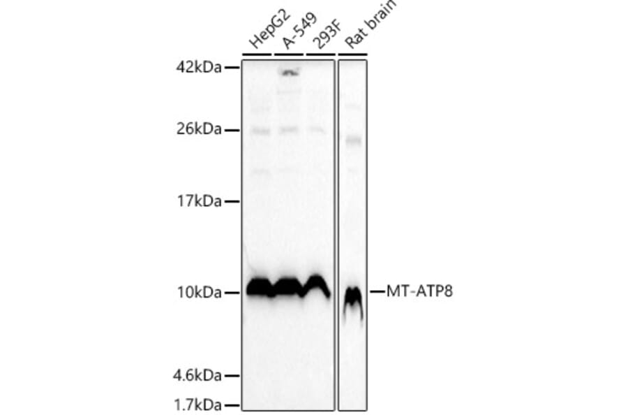 Western Blot - Anti-ATP8 Antibody (A93022) - Antibodies.com