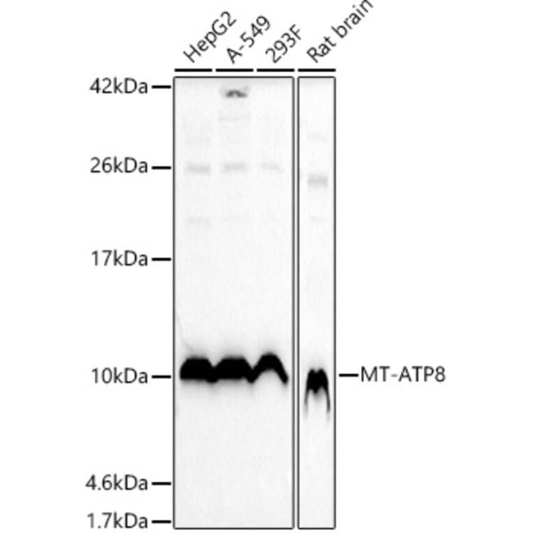Western Blot - Anti-ATP8 Antibody (A93022) - Antibodies.com