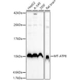 Western Blot - Anti-ATP8 Antibody (A93022) - Antibodies.com