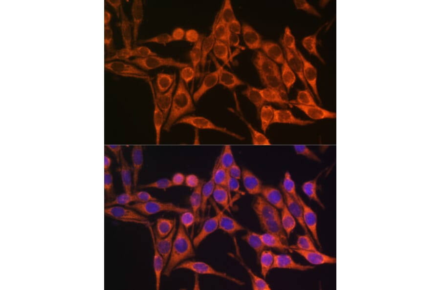 Immunofluorescence - Anti-ATP8 Antibody (A93022) - Antibodies.com