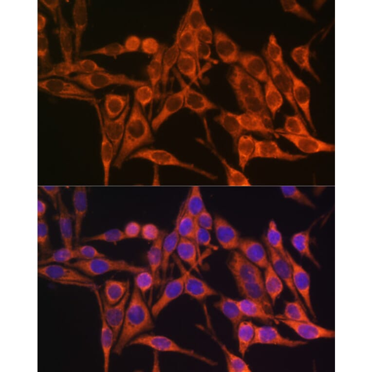 Immunofluorescence - Anti-ATP8 Antibody (A93022) - Antibodies.com