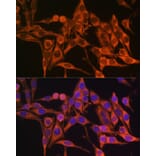 Immunofluorescence - Anti-ATP8 Antibody (A93022) - Antibodies.com