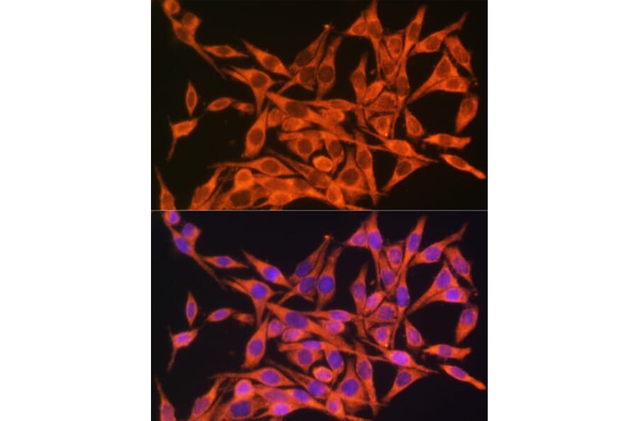 Immunofluorescence - Anti-ATP8 Antibody (A93022) - Antibodies.com