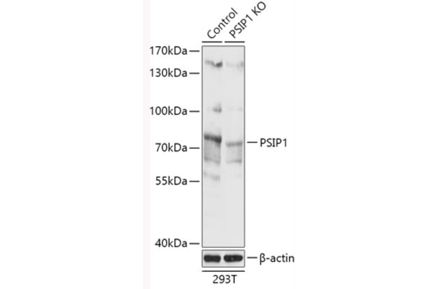 Western Blot - Anti-PSIP1/LEDGF Antibody (A93023) - Antibodies.com