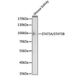 Western Blot - Anti-STAT5A + STAT5B Antibody (A93024) - Antibodies.com
