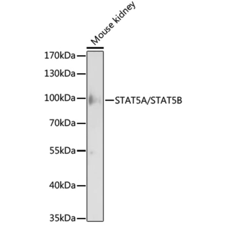 Western Blot - Anti-STAT5A + STAT5B Antibody (A93024) - Antibodies.com