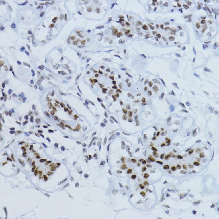 Immunohistochemistry - Anti-Smad2 (phospho Thr220) Antibody (A93028) - Antibodies.com