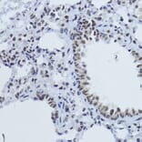 Immunohistochemistry - Anti-Smad2 (phospho Thr220) Antibody (A93028) - Antibodies.com