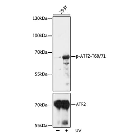 Western Blot - Anti-ATF2 (phospho Thr69 + Thr71) Antibody (A93029) - Antibodies.com