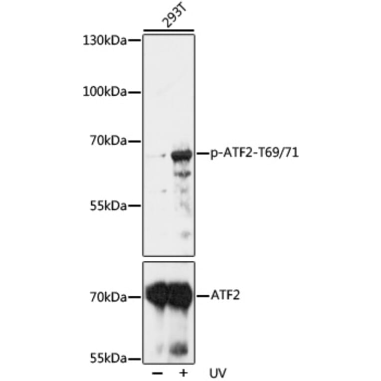 Western Blot - Anti-ATF2 (phospho Thr69 + Thr71) Antibody (A93029) - Antibodies.com