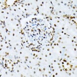 Immunohistochemistry - Anti-ATF2 (phospho Thr69 + Thr71) Antibody (A93029) - Antibodies.com