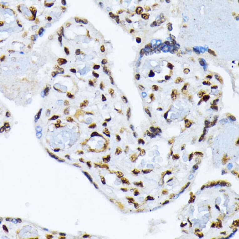 Immunohistochemistry - Anti-ATF2 (phospho Thr69 + Thr71) Antibody (A93029) - Antibodies.com