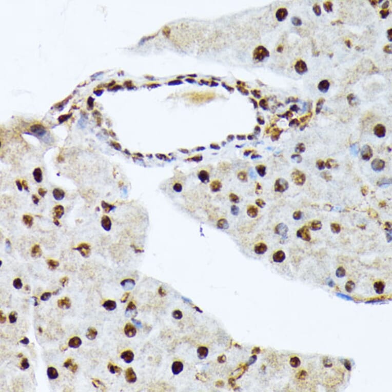Immunohistochemistry - Anti-ATF2 (phospho Thr69 + Thr71) Antibody (A93029) - Antibodies.com