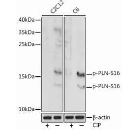 Western Blot - Anti-Phospholamban (phospho Ser16) Antibody (A93031) - Antibodies.com