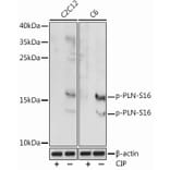Western Blot - Anti-Phospholamban (phospho Ser16) Antibody (A93031) - Antibodies.com