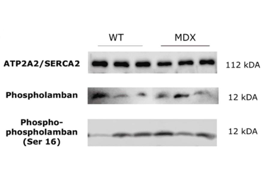 Western Blot - Anti-Phospholamban (phospho Ser16) Antibody (A93031) - Antibodies.com Citation
