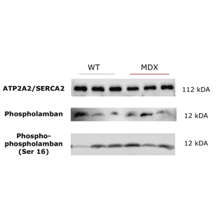 Western Blot - Anti-Phospholamban (phospho Ser16) Antibody (A93031) - Antibodies.com Citation
