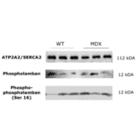 Western Blot - Anti-Phospholamban (phospho Ser16) Antibody (A93031) - Antibodies.com Citation