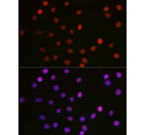 Immunofluorescence - Anti-HMGB1 (acetyl Lys29) Antibody (A93032) - Antibodies.com