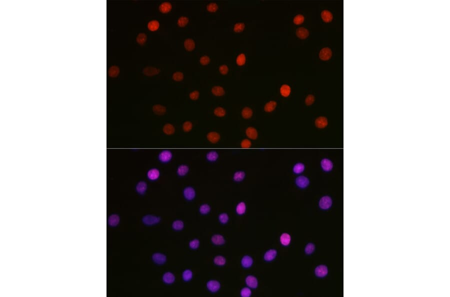 Immunofluorescence - Anti-HMGB1 (acetyl Lys29) Antibody (A93032) - Antibodies.com